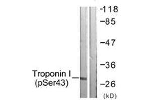 Western blot analysis of extracts from Jurkat cells, using TNNI3 (Phospho-Ser43) Antibody. (TNNI3 antibody  (pSer43))