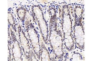 Immunohistochemistry analysis of paraffin-embedded rat stomach node using MGMT Polyclonal Antibody at dilution of 1:300. (MGMT antibody)