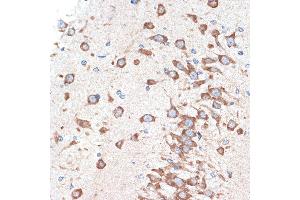 Immunohistochemistry of paraffin-embedded rat brain using  Rabbit mAb (ABIN7265453) at dilution of 1:100 (40x lens). (ADORA1 antibody)