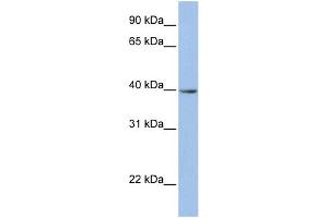 WB Suggested Anti-ZNF202 Antibody Titration:  0. (ZNF202 antibody  (N-Term))