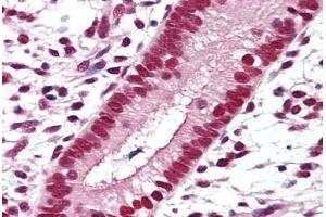 Anti-RXRB antibody IHC staining of human uterus. (Retinoid X Receptor beta antibody  (Hinge Region))