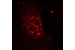 Image no. 3 for anti-V-Akt Murine Thymoma Viral Oncogene Homolog 1 (AKT1) (pThr308) antibody (ABIN196710) (AKT1 antibody  (pThr308))
