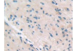 Immunohistochemistry (IHC) image for anti-Integrin beta 5 (ITGB5) (AA 137-378) antibody (ABIN7440758)