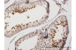 Immunoperoxidase of purified MaxPab antibody to SPA17 on formalin-fixed paraffin-embedded human testis. (SPA17 antibody  (AA 1-151))