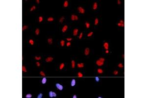 Immunofluorescence analysis of U2OS cells using Phospho-MET(Y1234) Polyclonal Antibody (c-MET antibody  (pTyr1234))