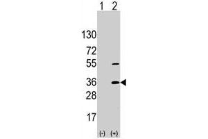 Western blot analysis of SSR1 (arrow) using SSR1 polyclonal antibody . (SSR1 antibody  (N-Term))