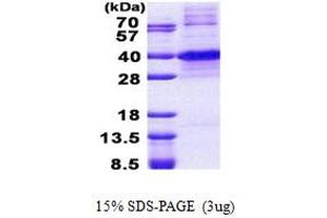 SDS-PAGE (SDS) image for Kruppel-Like Factor 7 (Ubiquitous) (KLF7) (AA 1-302) protein (His tag) (ABIN5853049)