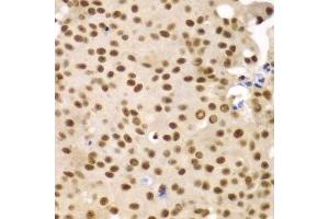 Immunohistochemistry (Paraffin-embedded Sections) (IHC (p)) image for anti-Splicing Factor 3b, Subunit 2, 145kDa (SF3B2) (AA 616-895) antibody (ABIN6147666)