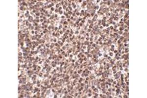 Immunohistochemistry of TREX1 in human spleen tissue with this product at 2. (TREX1 antibody  (Center))