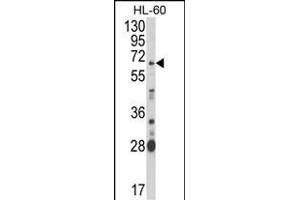 Western blot analysis of ARSB Antibody (Center) (ABIN652346 and ABIN2841582) in HL-60 cell line lysates (35 μg/lane). (Arylsulfatase B antibody  (AA 235-266))