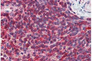 Human Spleen: Formalin-Fixed, Paraffin-Embedded (FFPE) (PIP4K2A antibody  (AA 304-366))