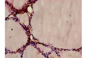 Immunohistochemistry of paraffin-embedded human thyroid tissue using ABIN7144296 at dilution of 1:100 (Annexin A9 antibody  (AA 8-345))