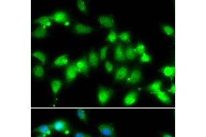 Immunofluorescence analysis of HeLa cells using AKAP5 Polyclonal Antibody at dilution of 1:100. (AKAP5 antibody)