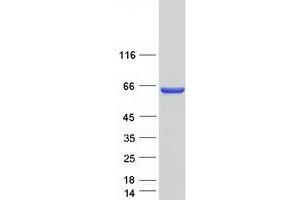 Coiled-Coil Domain Containing 149 (CCDC149) (Transcript Variant 2) protein (Myc-DYKDDDDK Tag)