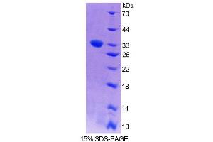 SDS-PAGE analysis of Mouse PCYOX1 Protein. (PCYOX1 Protein)