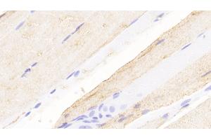 Detection of NMU in Rat Skeletal muscle Tissue using Polyclonal Antibody to Neuromedin U (NMU) (Neuromedin U antibody  (AA 38-174))