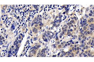 Immunohistochemistry (IHC) image for anti-BCL2-Associated Agonist of Cell Death (BAD) (AA 1-168) antibody (ABIN7443224)