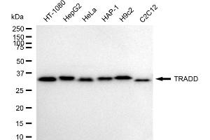anti-TNFRSF1A-Associated Via Death Domain (TRADD) antibody