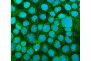 IF analysis of ICAM1 using anti-ICAM1 antibody (ABIN5692991).