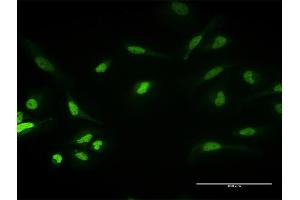 Immunofluorescence of purified MaxPab antibody to PKNOX1 on HeLa cell. (PKNOX1 antibody  (AA 1-436))