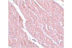 Immunohistochemistry of ATG13 in mouse heart with ATG13 antibody at 5 μg/ml. (ATG13 antibody  (C-Term))