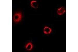 Immunofluorescent analysis of BRCC2 staining in MCF7 cells. (BRCA2 antibody)