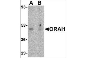 Western blot analysis of ORAI1 in human ovary tissue lysate with this product at 1 μg/ml in the (A) absence or (B) presence of blocking peptide. (ORAI1 antibody  (N-Term))