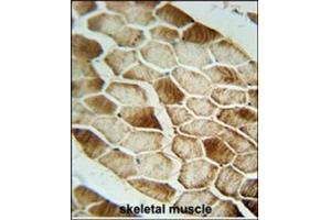 Immunohistochemistry analysis in Formalin Fixed, Paraffin Embedded Human skeletal muscle stained with SAR1B antibody (Center) followed by peroxidase conjugation of the secondary antibody and DAB staining. (SAR1B antibody  (Middle Region))