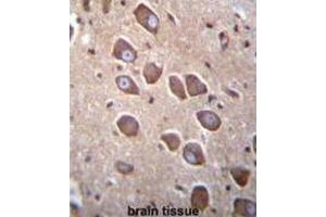 Immunohistochemistry (IHC) image for anti-Protocadherin alpha 3 (PCDHA3) antibody (ABIN2996548) (PCDHA3 antibody)