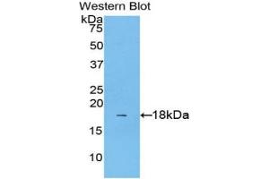 Western blot analysis of the recombinant protein. (IL1A antibody  (AA 111-204))