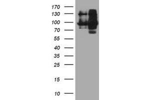 HEK293T cells were transfected with the pCMV6-ENTRY control (Left lane) or pCMV6-ENTRY DPP9 (Right lane) cDNA for 48 hrs and lysed. (DPP9 antibody)