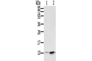 Western Blotting (WB) image for anti-S100 Calcium Binding Protein P (S100P) antibody (ABIN5548798) (S100P antibody)