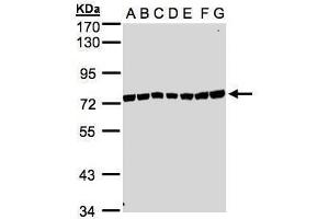 WB Image Sample(30μg whole cell lysate) A: 293T B: A431 , C: H1299 D: HeLa S3 , E: Hep G2 , F: MOLT4 , G: Raji , 7. (UVSSA/KIAA1530 antibody  (N-Term))