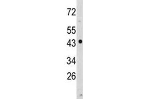 Western Blotting (WB) image for anti-N-Myc Downstream Regulated 1 (NDRG1) (AA 12-40) antibody (ABIN3028862)