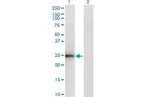 Western Blotting (WB) image for anti-Cell Death-Inducing DFFA-Like Effector B (CIDEB) (AA 3-111) antibody (ABIN599215) (CIDEB antibody  (AA 3-111))