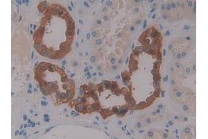 IHC-P analysis of Human Kidney Tissue, with DAB staining. (CCL13 antibody  (AA 24-98))