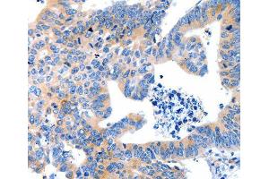 Immunohistochemistry (IHC) image for anti-Low Density Lipoprotein Receptor-Related Protein Associated Protein 1 (LRPAP1) antibody (ABIN1680715) (LRPAP1 antibody)