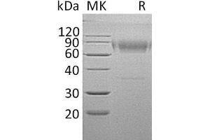 Interleukin 18 Binding Protein (IL18BP) protein (Fc Tag)
