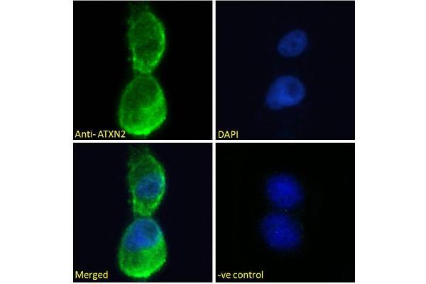 Ataxin 2 antibody  (Internal Region)