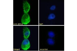 ABIN570879 Immunofluorescence analysis of paraformaldehyde fixed U2OS cells, permeabilized with 0. (Ataxin 2 antibody  (Internal Region))