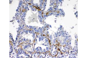 IHC analysis of VEGFD using anti-VEGFD antibody . (VEGFD antibody  (AA 89-205))