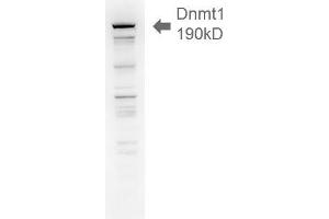 Dnmt1, 18ug H1299 lysate 1 in1000 Western Blotting.