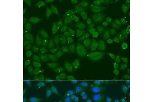 Immunofluorescence analysis of U2OS cells using INPP5K Polyclonal Antibody at dilution of 1:100. (INPP5K antibody)