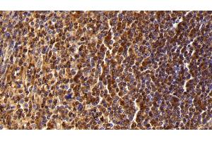 Immunohistochemistry (IHC) image for anti-Protein tyrosine Phosphatase, Receptor Type, C (PTPRC) (AA 371-556) antibody (ABIN7437023)