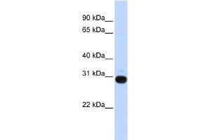 WB Suggested Anti-VASH1 Antibody Titration: 0. (VASH1 antibody  (Middle Region))