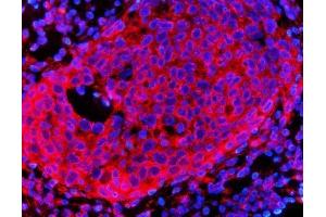 IF analysis of HMGCR using anti-HMGCR antibody (ABIN7600989).