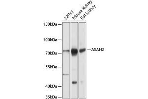 Western blot analysis of extracts of various cell lines, using  antibody (ABIN6129935, ABIN6137162, ABIN6137164 and ABIN6216285) at 1:1000 dilution. (ASAH2 antibody  (AA 80-340))