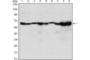 CARM1 antibody