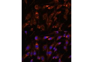 Immunofluorescence analysis of C6 cells using FARSB antibody (ABIN7269267) at dilution of 1:100. (FARSB antibody  (AA 240-589))