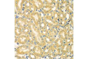Immunohistochemistry of paraffin-embedded mouse kidney using MOCS3 antibody (ABIN5975123) at dilution of 1/100 (40x lens). (MOCS3 antibody)